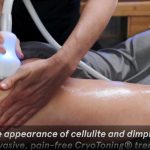TLC Cryo & More