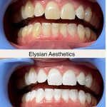 Elysian Aesthetics Spa LLC.