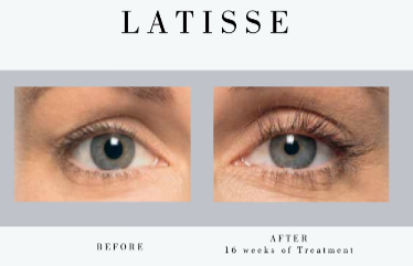 Elysium Medical Aesthetics Latisse Eyelash & Growth Serum