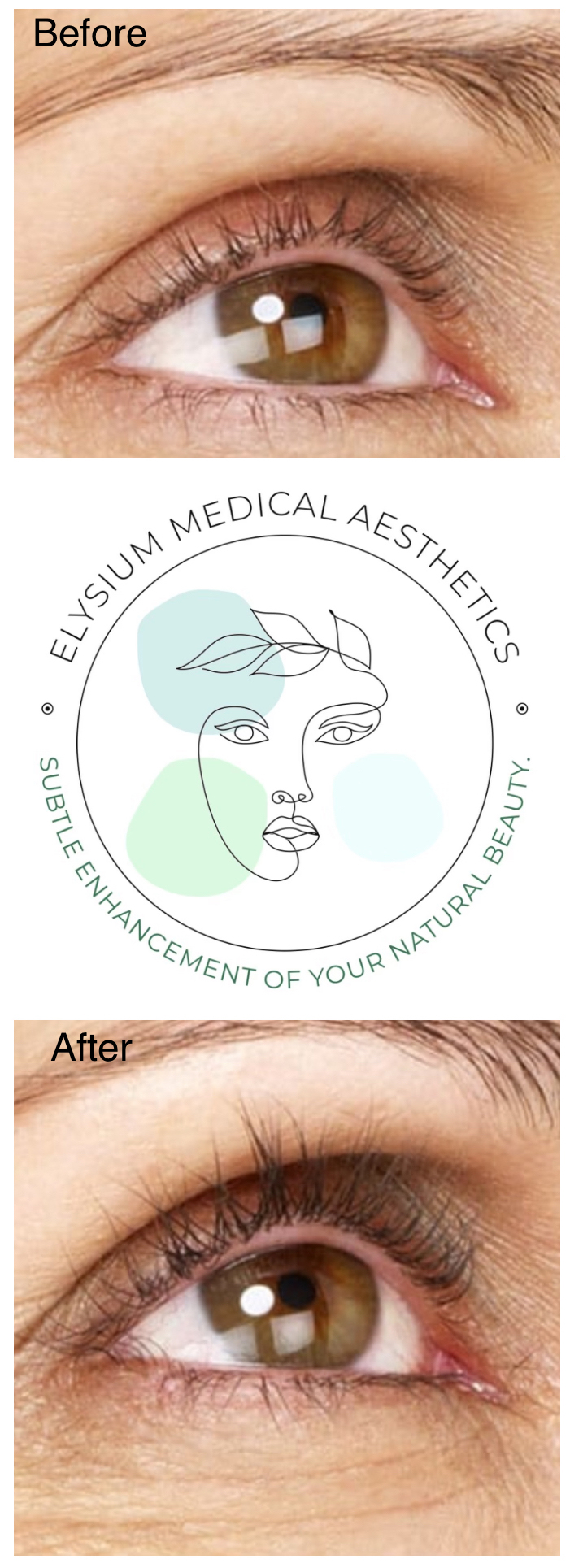 Elysium Medical Aesthetics Latisse Eyelash & Growth Serum