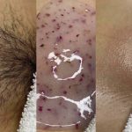 Marcy Spa & Laser