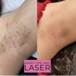 Marcy Spa & Laser
